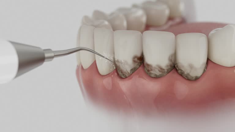 Reliable Dental contractor in Sellersburg, IN by Dentist Open Now